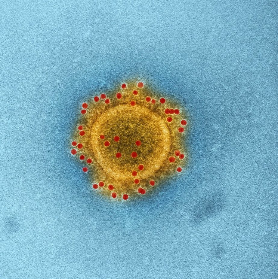 coronavirus-under-microscope-with-blue-background-to-emphasize-the-infections-and-diseases